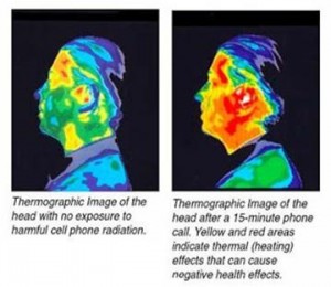 Microwave Radiation Effect After a Phone Call