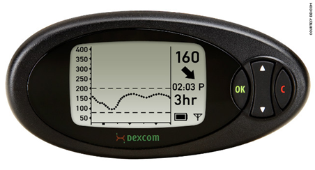 Dexcom