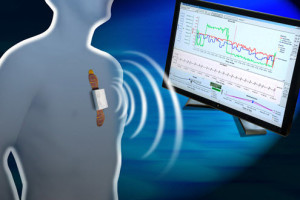 Patient Monitoring System
