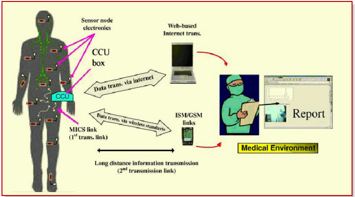 Medical Applications Based on Wireless Sensor Networks