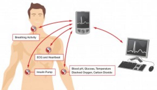 Body Area Network