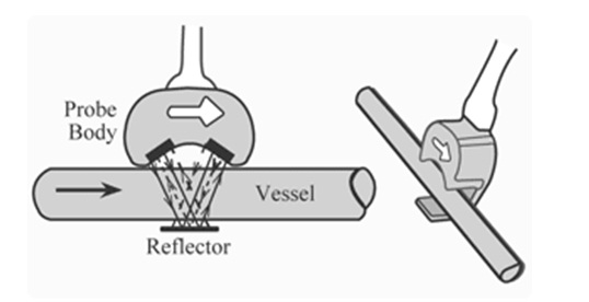 Ultrasonic-Flow-Meter-Construction